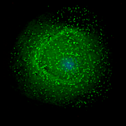 180px-HIV_on_macrophage.png
